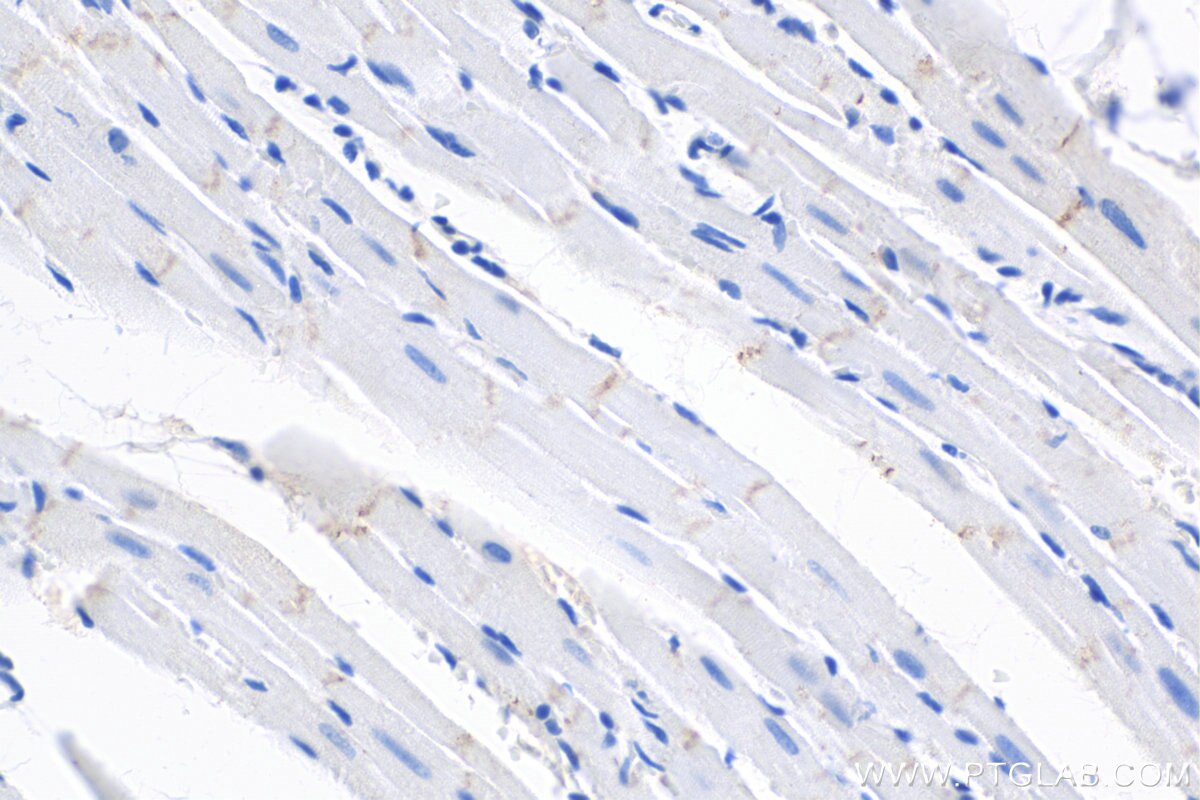 IHC staining of rat heart using 25318-1-PBS