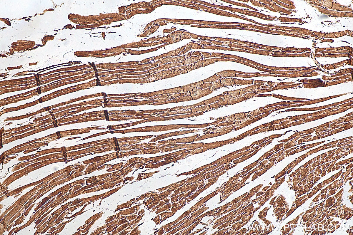Immunohistochemistry (IHC) staining of mouse heart tissue using Desmoplakin Polyclonal antibody (25318-1-AP)