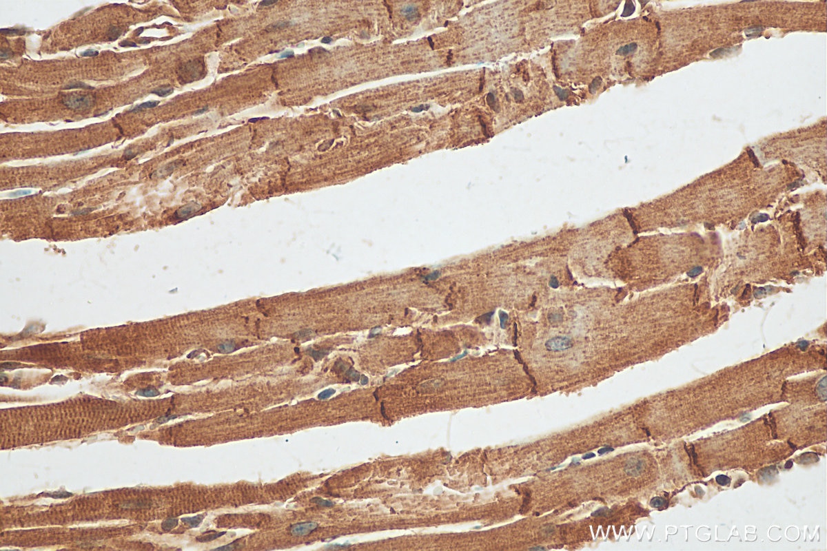 IHC staining of mouse heart using 25318-1-AP