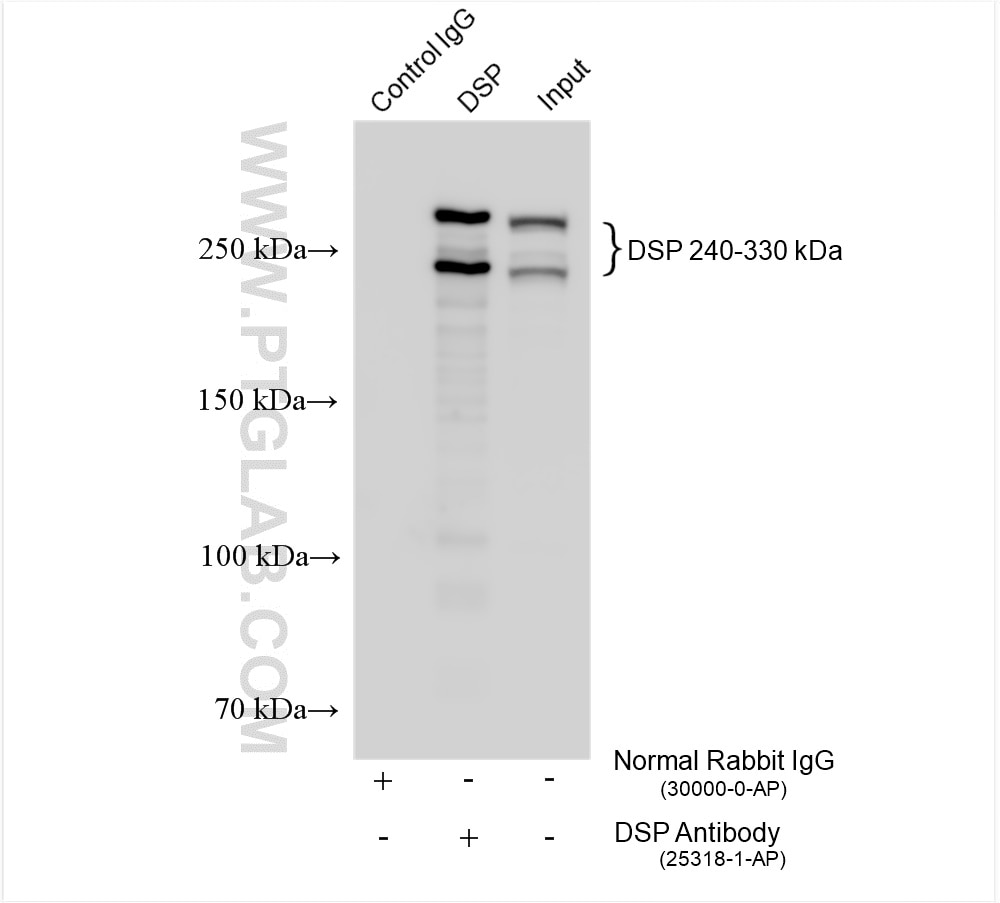 Immunoprecipitation (IP) experiment of BxPC-3 cells using Desmoplakin Polyclonal antibody (25318-1-AP)