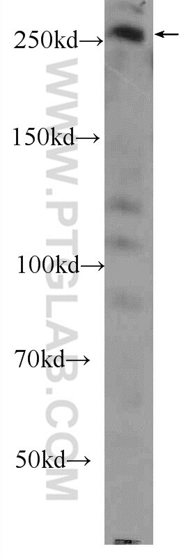 Western Blot (WB) analysis of HeLa cells using Desmoplakin Polyclonal antibody (25318-1-AP)