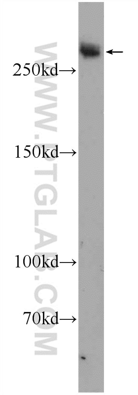 Western Blot (WB) analysis of mouse heart tissue using Desmoplakin Polyclonal antibody (25318-1-AP)