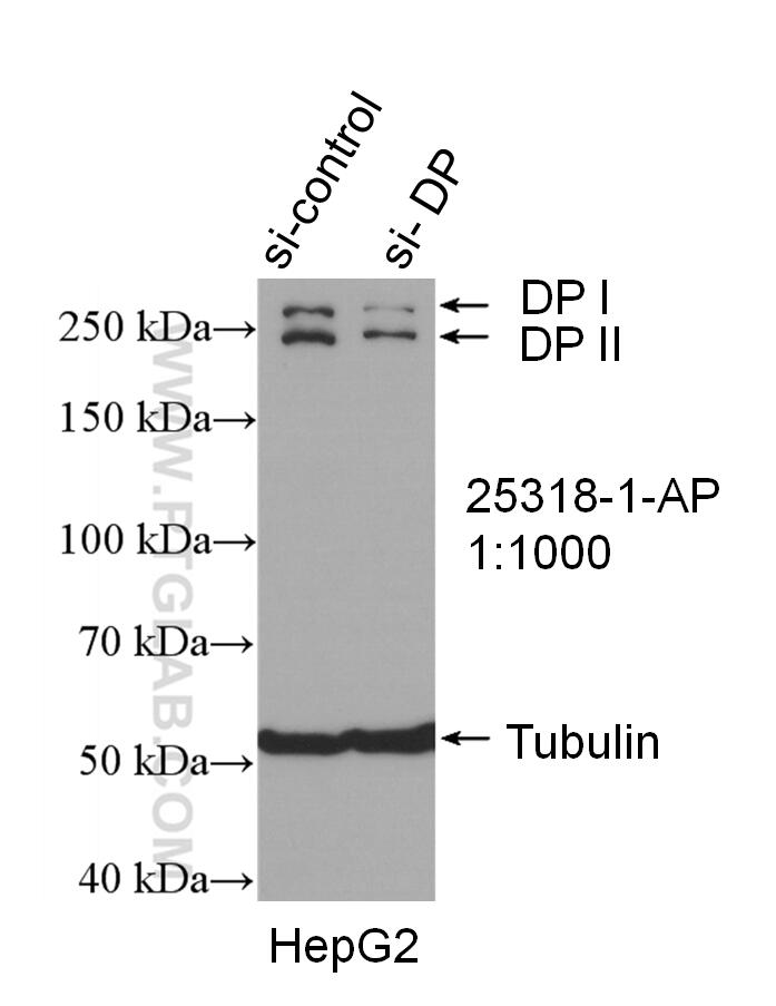 Western Blot (WB) analysis of HepG2 cells using Desmoplakin Polyclonal antibody (25318-1-AP)