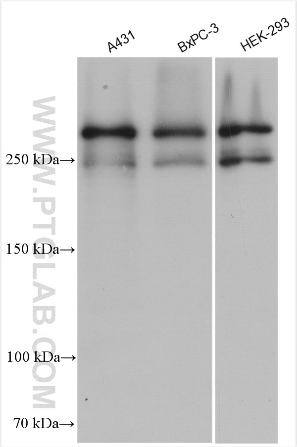 Western Blot (WB) analysis of various lysates using Desmoplakin Polyclonal antibody (25318-1-AP)