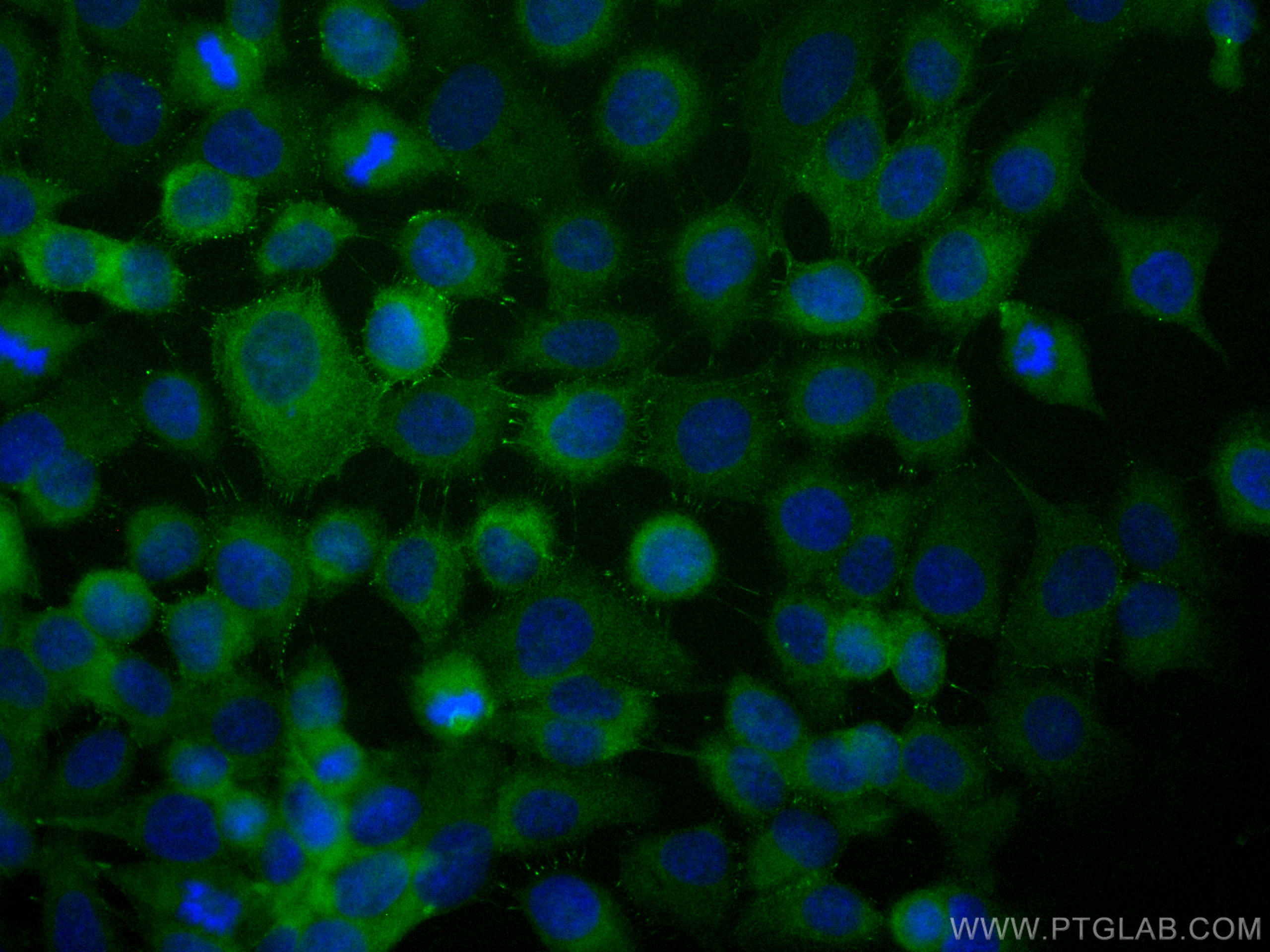 Immunofluorescence (IF) / fluorescent staining of A431 cells using CoraLite® Plus 488-conjugated Desmoplakin Polyclon (CL488-25318)