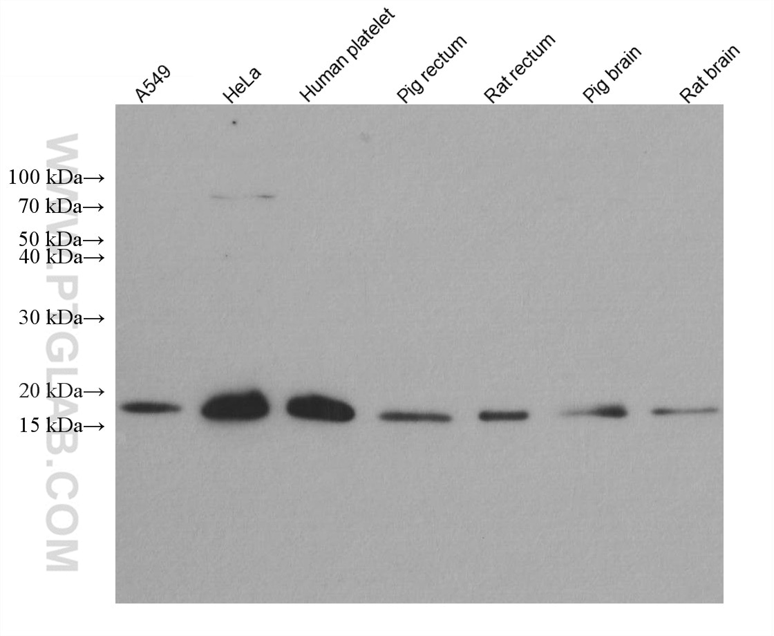 Western Blot (WB) analysis of various lysates using Destrin Monoclonal antibody (67657-1-Ig)
