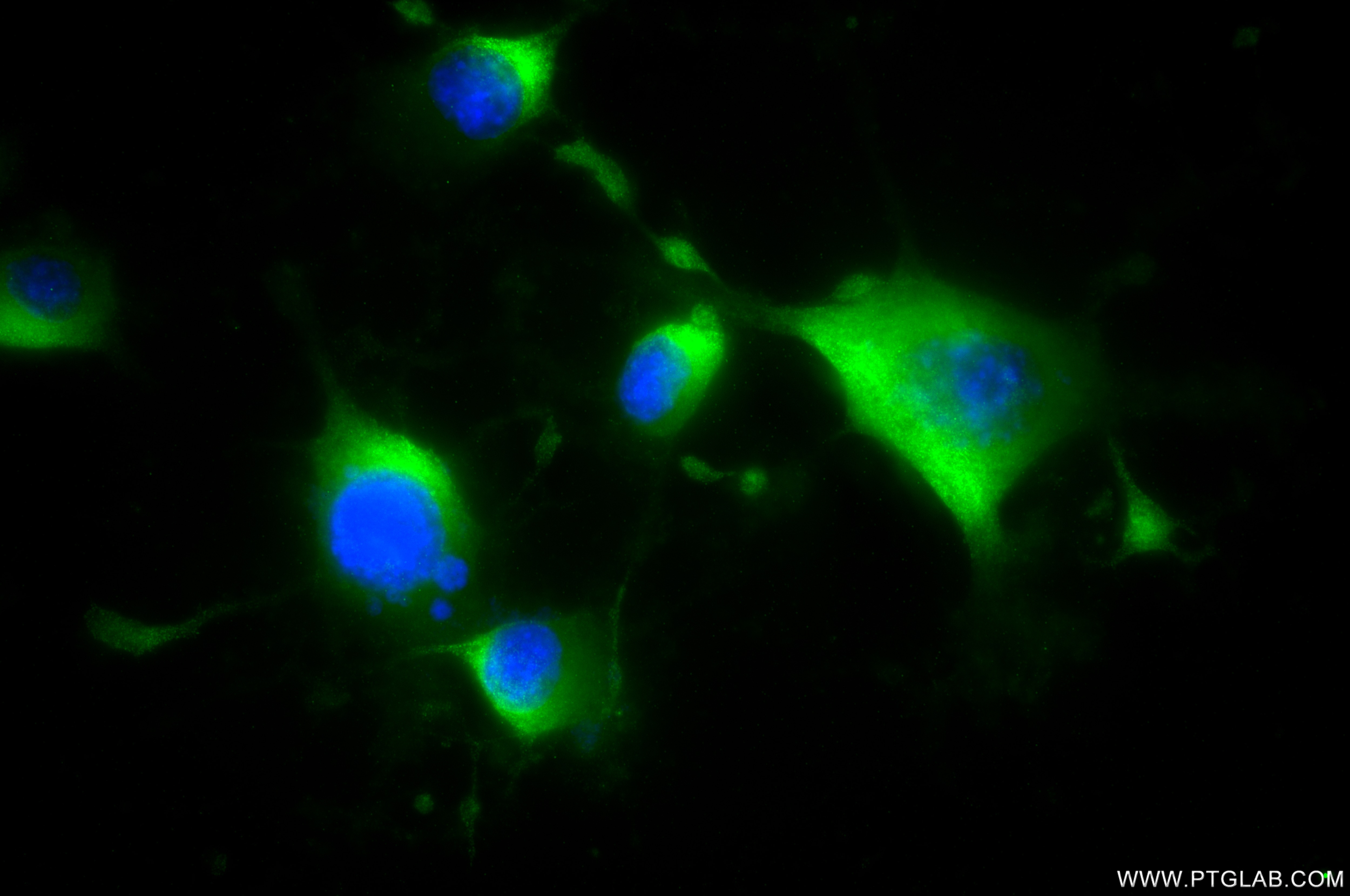 IF Staining of Neuro-2a using 82955-2-RR Immunofluorescence (IF) / fluorescent staining of Neuro-2a cells using DFNA5/GSDME Recombinant monoclonal antibody (82955-2-RR)