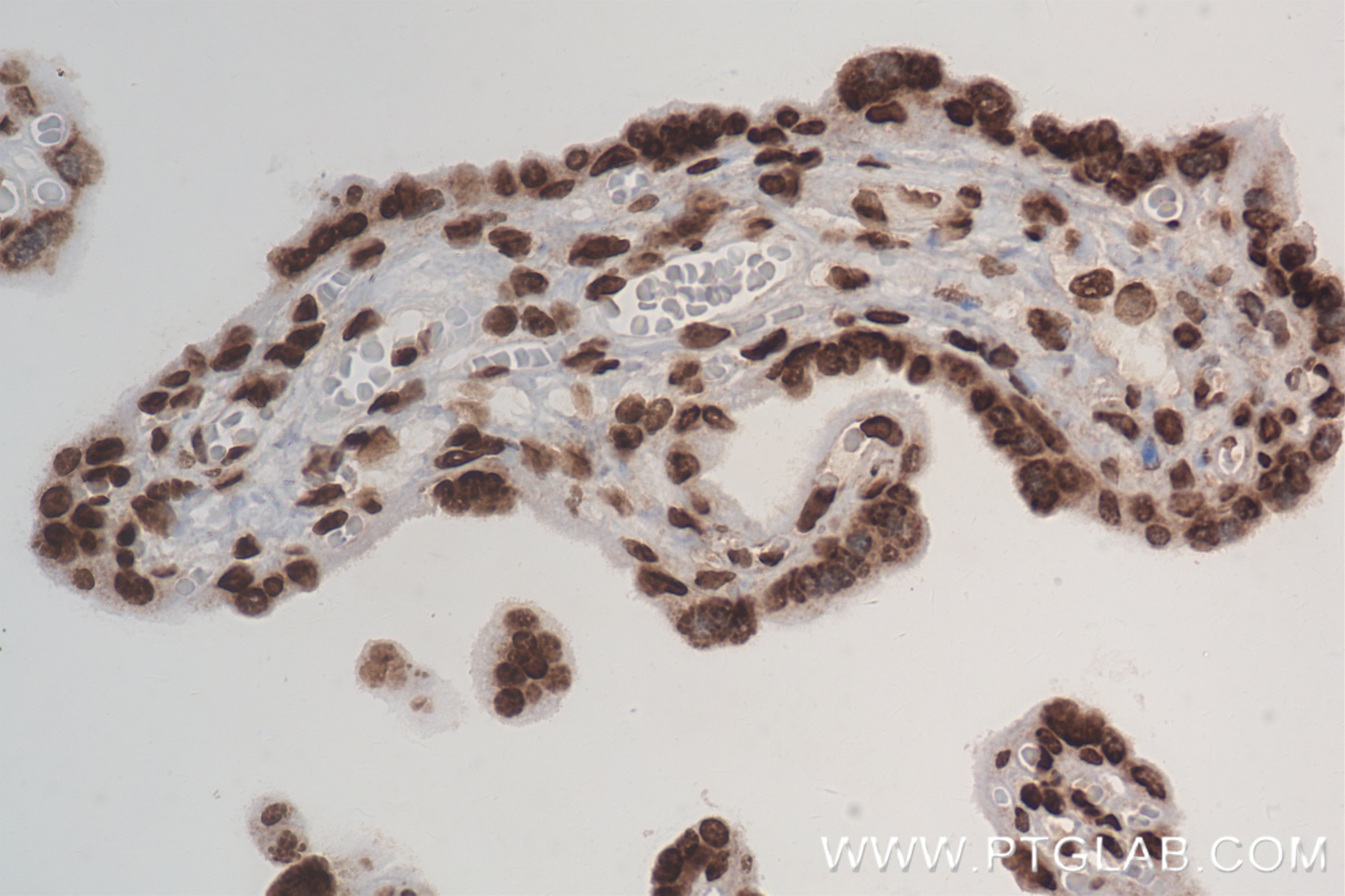Immunohistochemistry (IHC) staining of human placenta tissue using Di-Methyl-Histone H3 (Arg2)  Recombinant antibody (84702-1-RR)