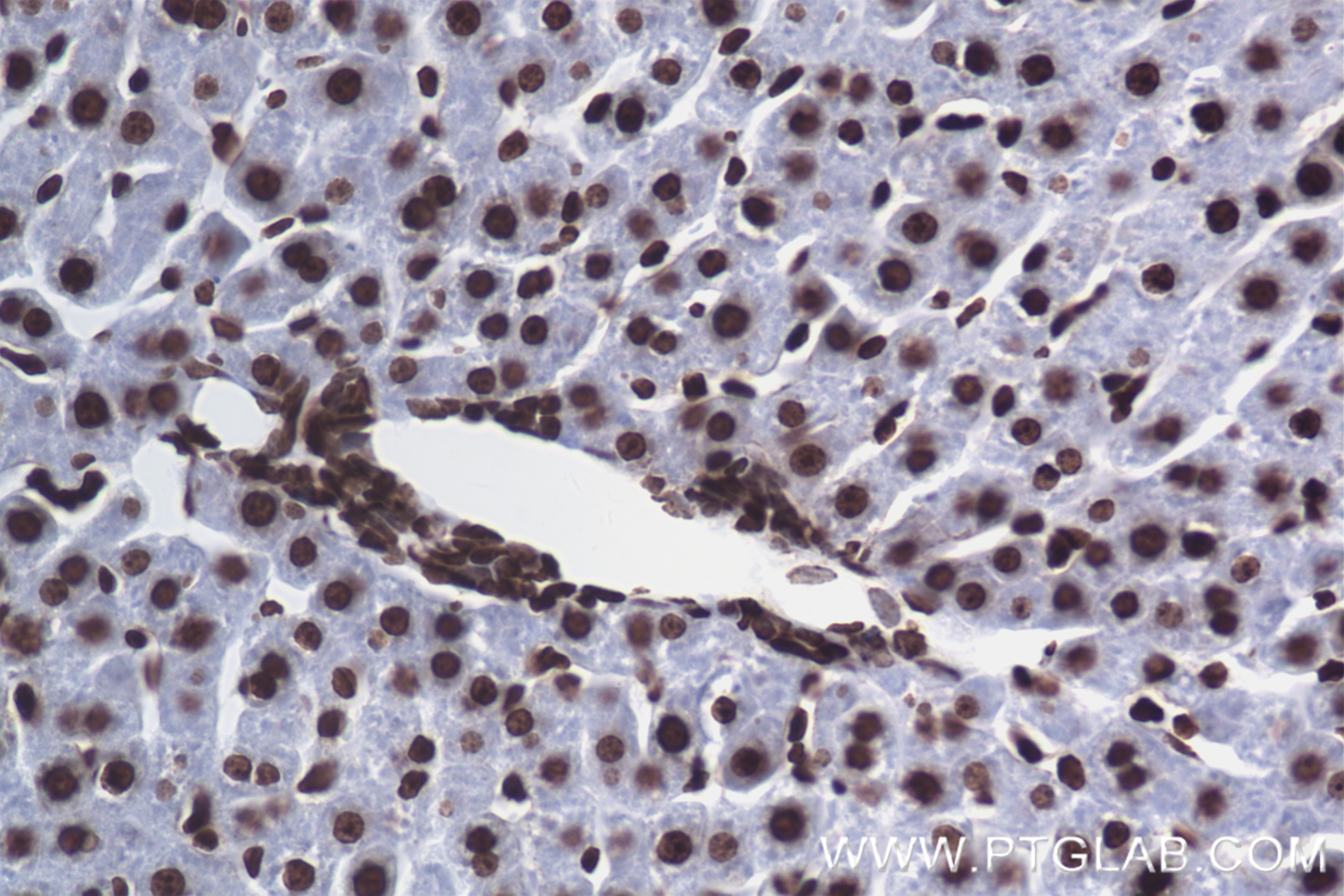 Immunohistochemistry (IHC) staining of rat liver tissue using Di-Methyl-Histone H3 (Arg2)  Recombinant antibody (84702-1-RR)