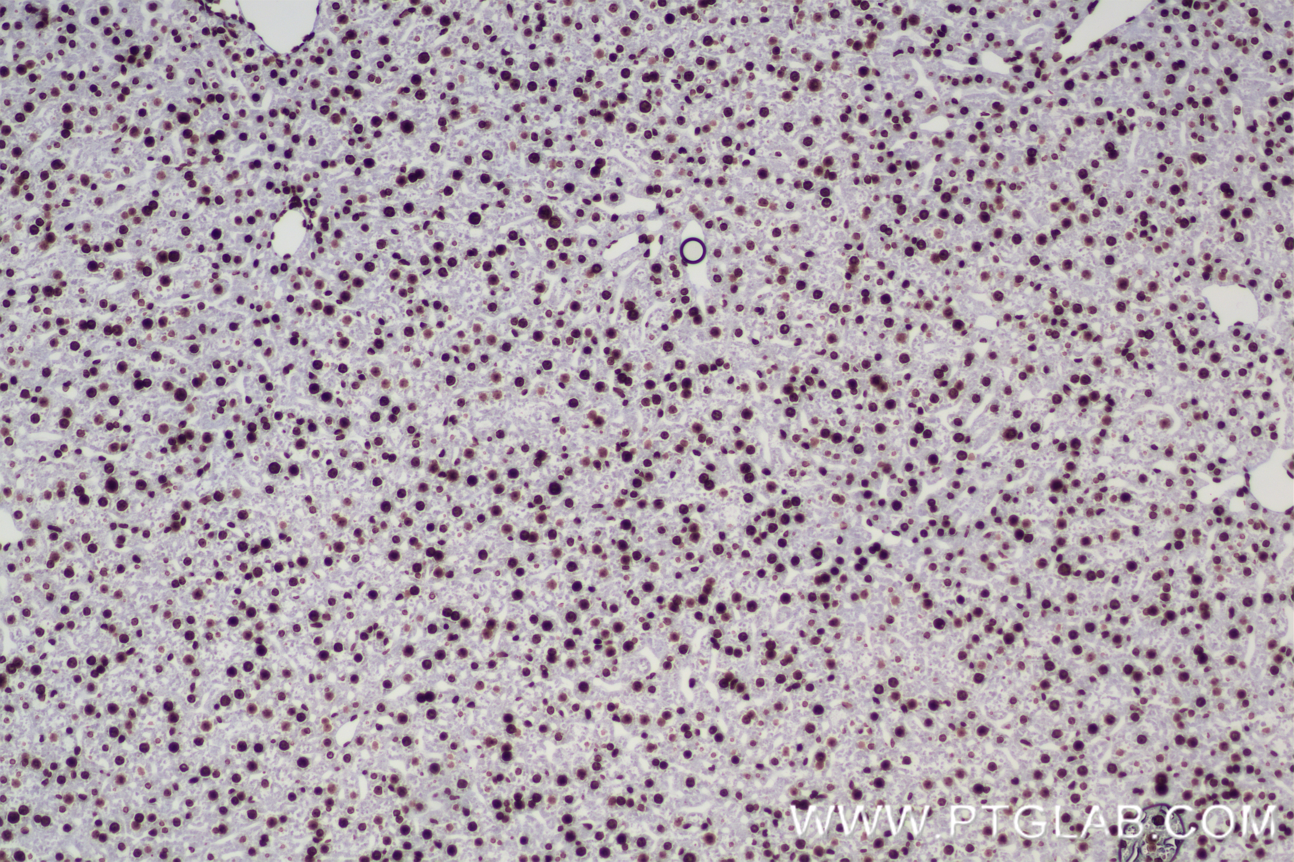 Immunohistochemistry (IHC) staining of mouse liver tissue using Di-Methyl-Histone H3 (Arg2)  Recombinant antibody (84702-1-RR)