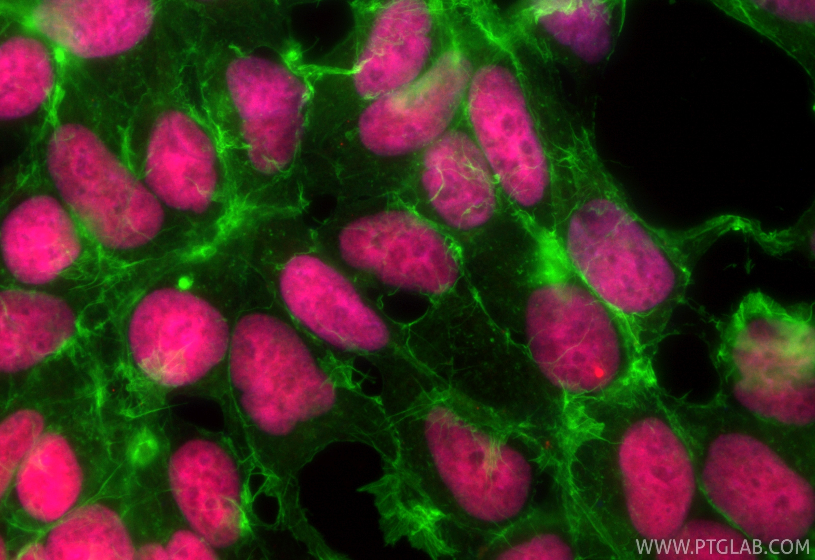 Immunofluorescence (IF) / fluorescent staining of HEK-293 cells using CoraLite®594-conjugated Di-Methyl-Histone H3 (Arg2 (CL594-84702)