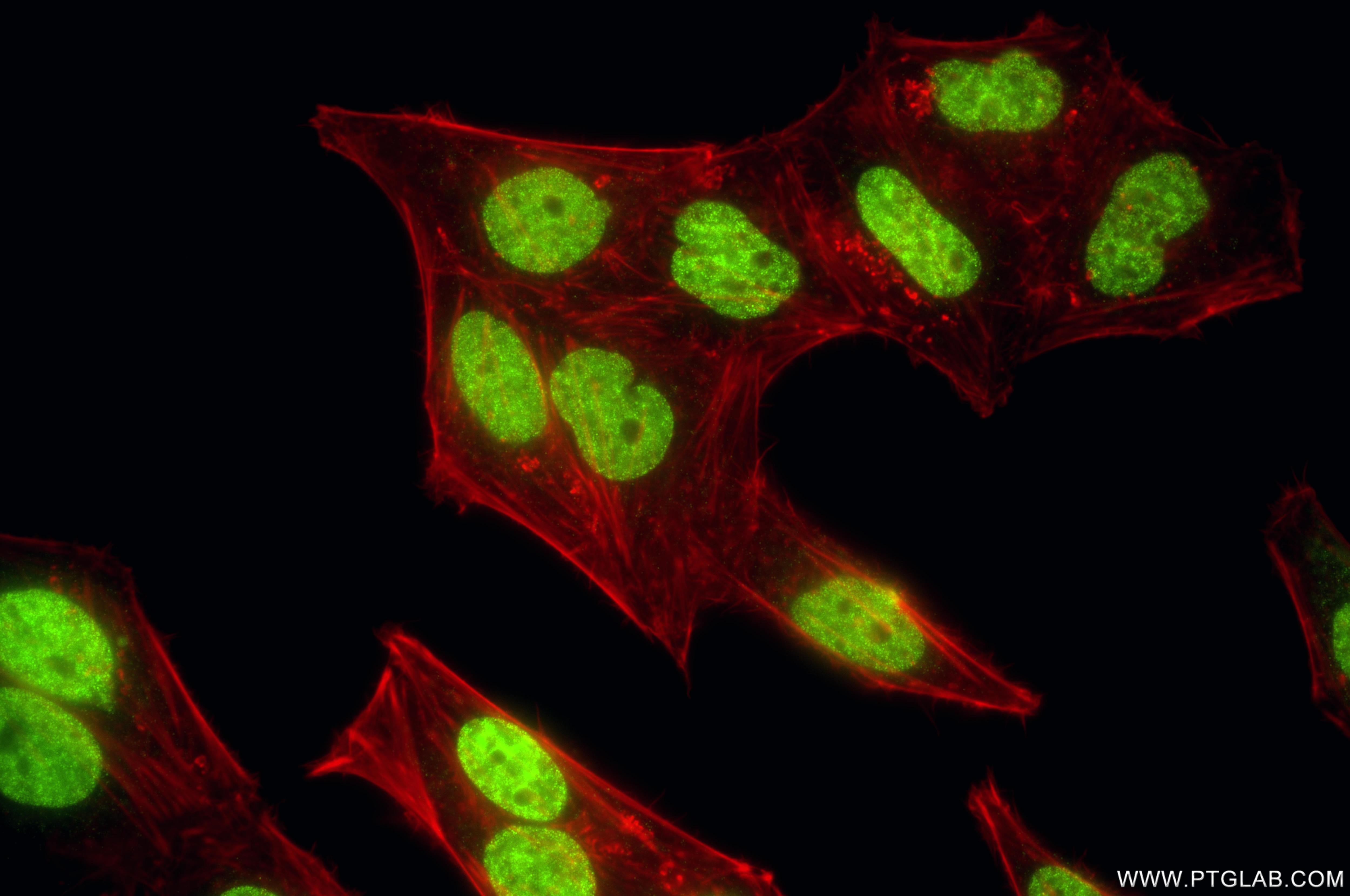 Immunofluorescence (IF) / fluorescent staining of HepG2 cells using Di-Methyl-Histone H3 (Lys56) Recombinant monoclona (82828-12-RR)