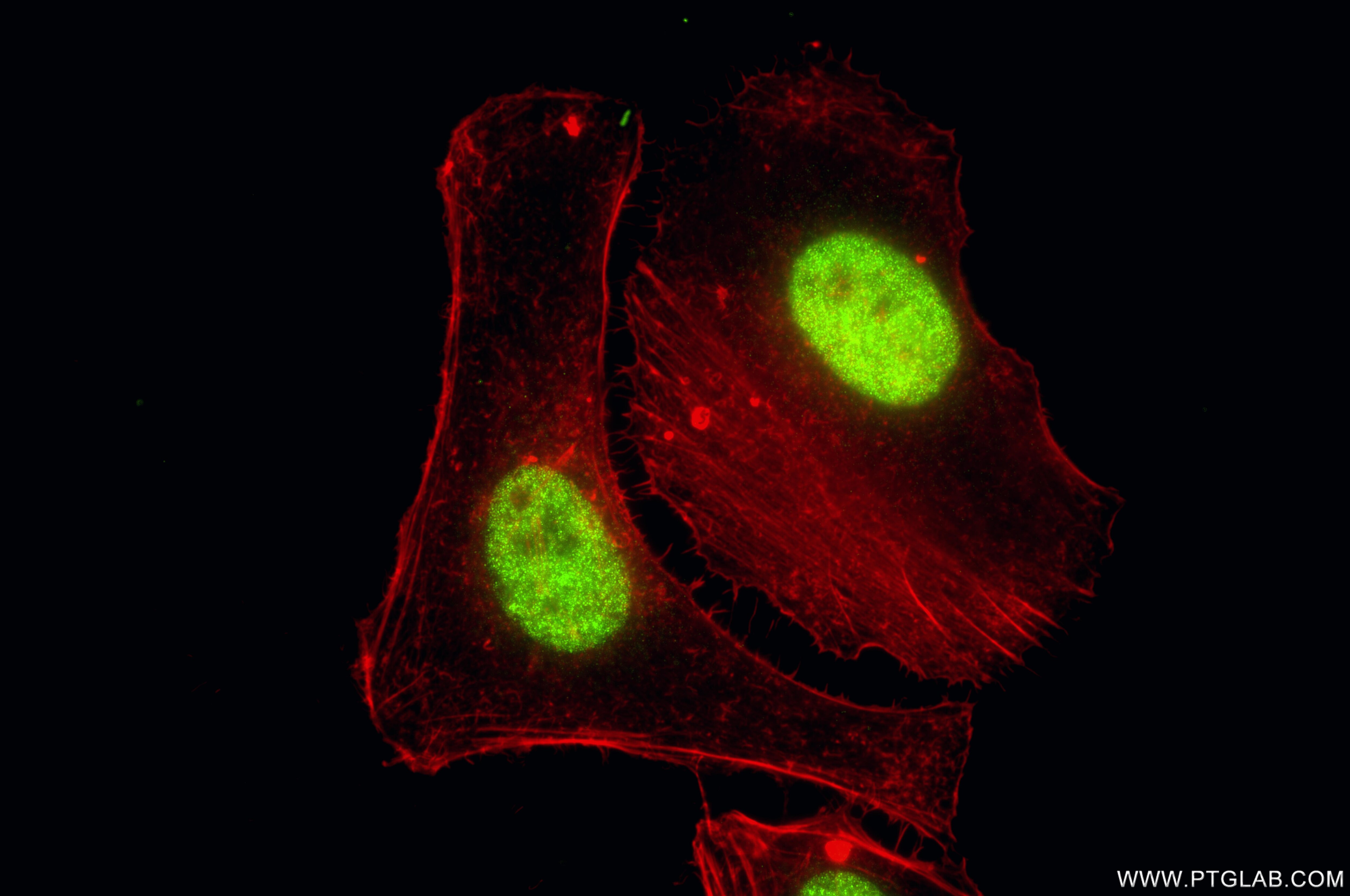 Immunofluorescence (IF) / fluorescent staining of HeLa cells using Di-Methyl-Histone H4 (Lys20) Recombinant monoclona (87006-1-RR)