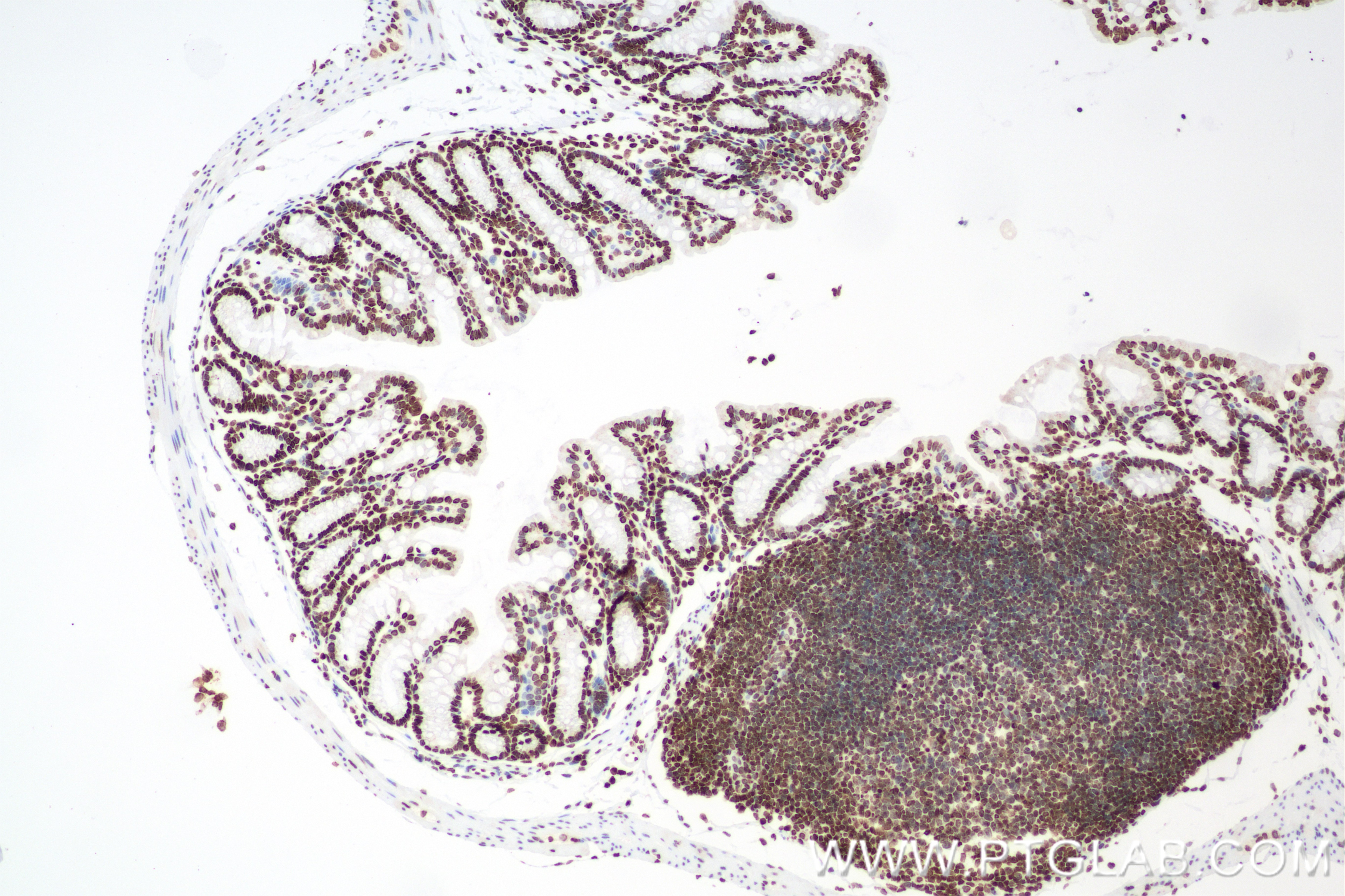 Immunohistochemistry (IHC) staining of mouse colon tissue using Di-Methyl-Histone H4 (Lys20) Recombinant monoclona (87006-1-RR)