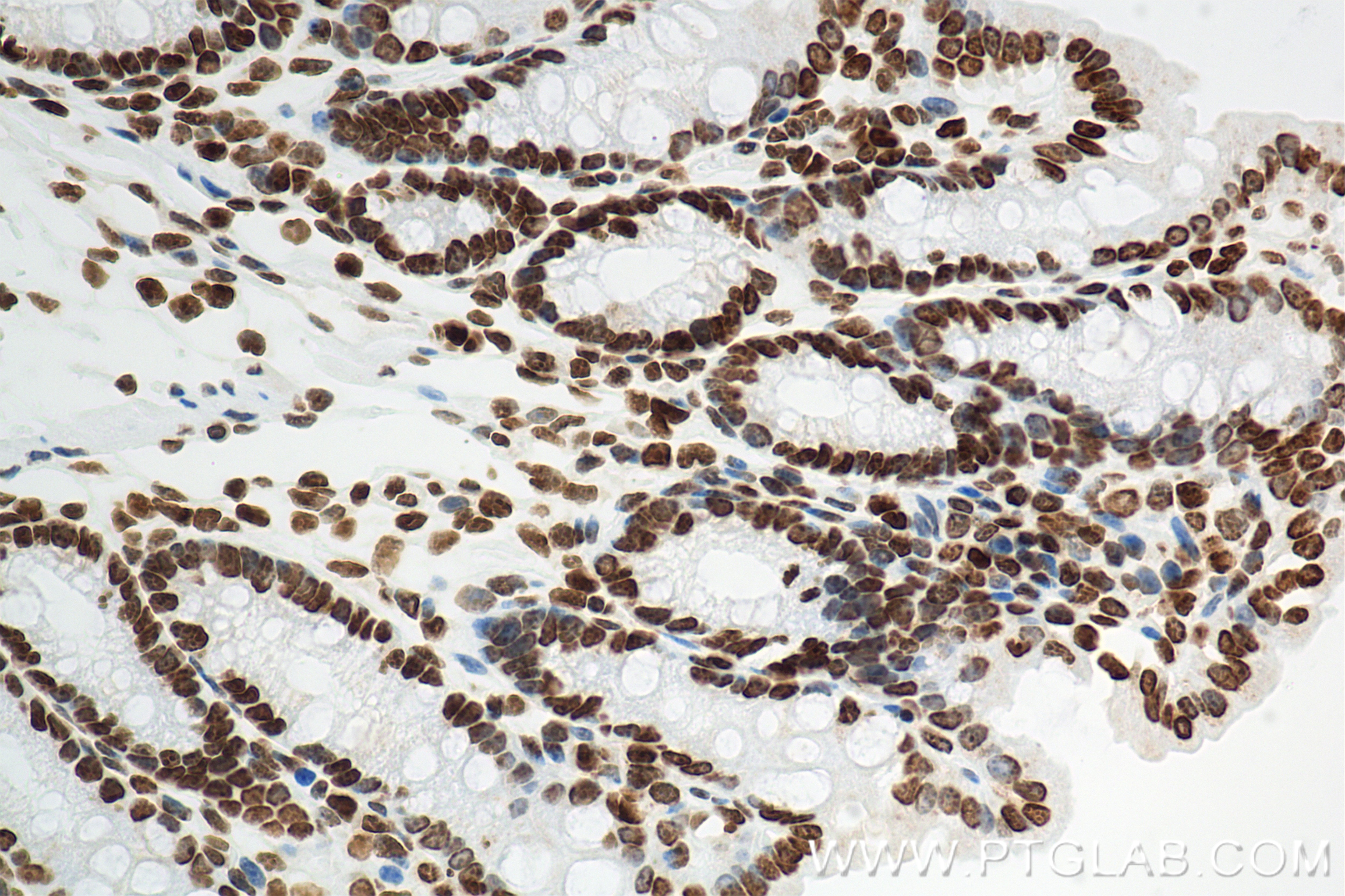 Immunohistochemistry (IHC) staining of mouse colon tissue using Di-Methyl-Histone H4 (Lys20) Recombinant monoclona (87006-1-RR)