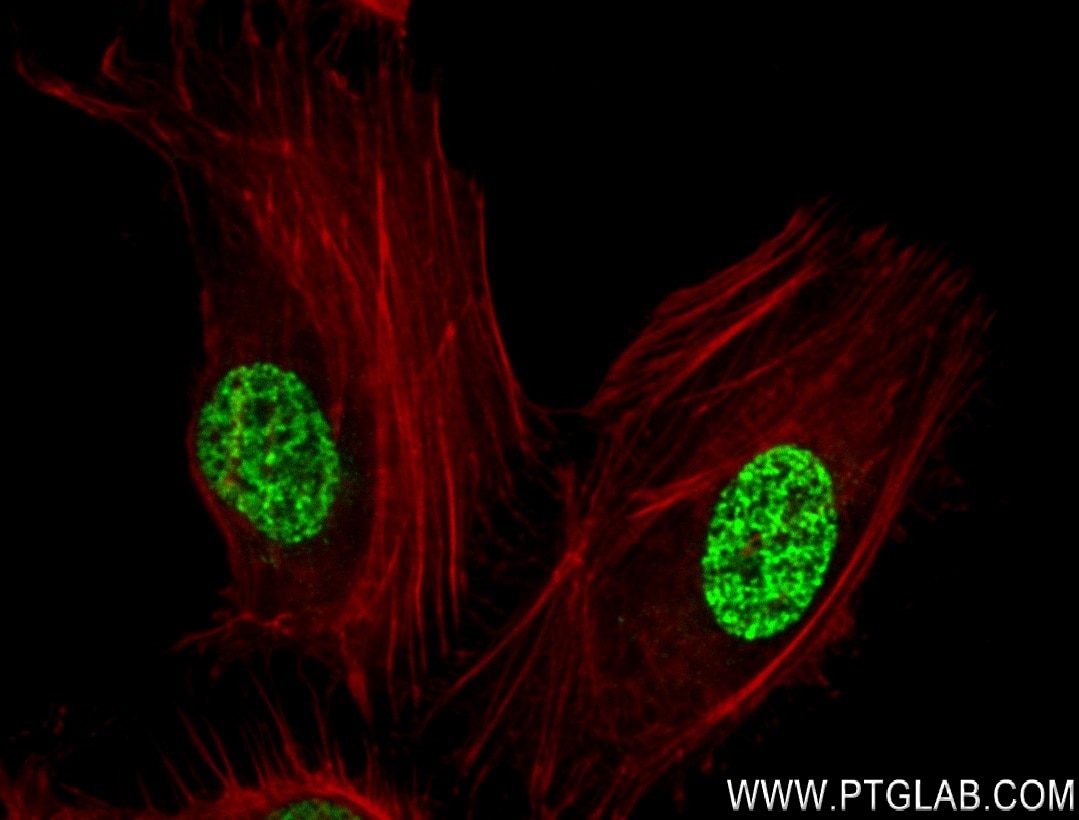 Immunofluorescence (IF) / fluorescent staining of HeLa cells using Di/Tri-Methyl-Histone H3 (Lys36) Recombinant antib (84329-1-RR)
