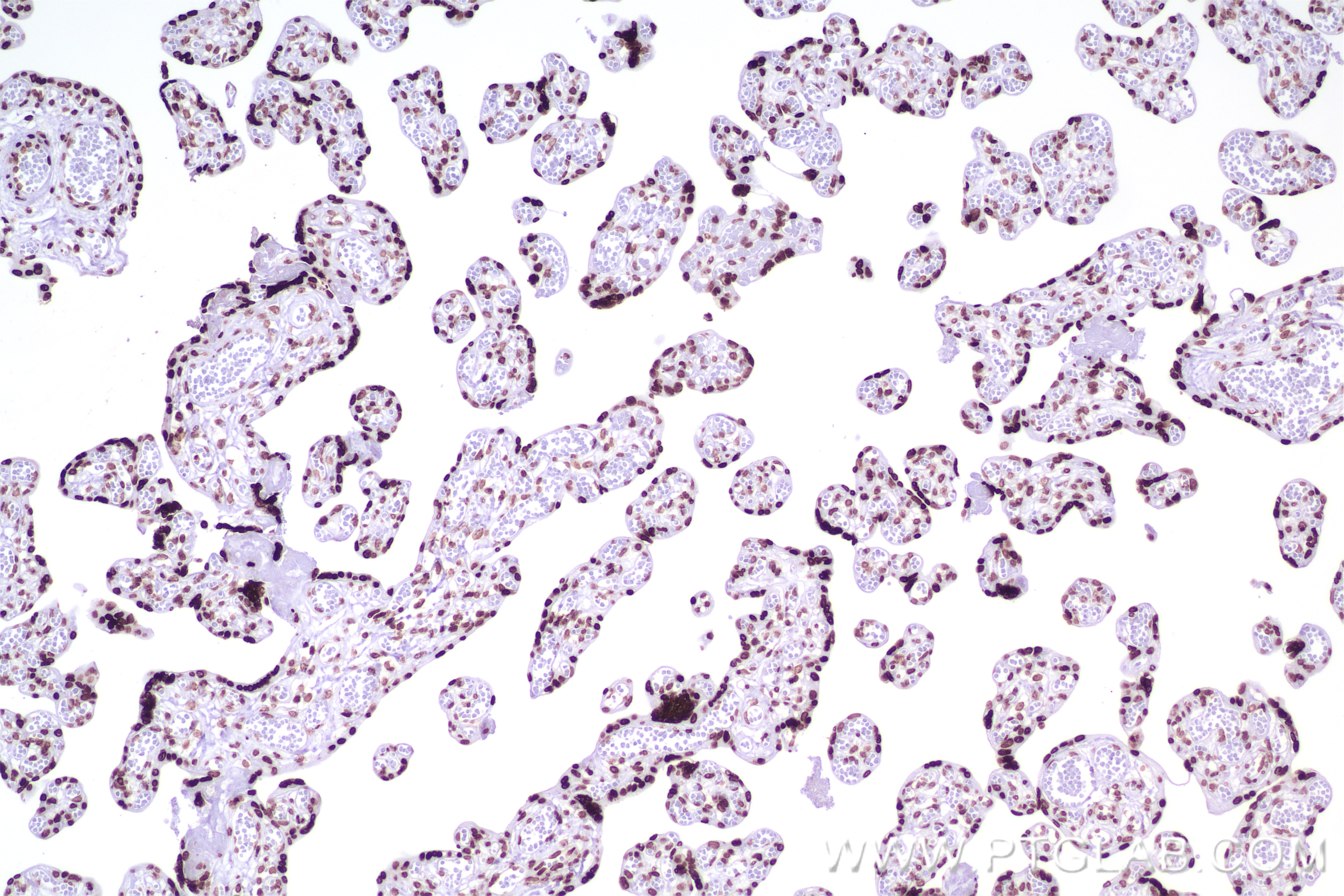Immunohistochemistry (IHC) staining of human placenta tissue using Di/Tri-Methyl-Histone H3 (Lys36) Recombinant antib (84329-1-RR)