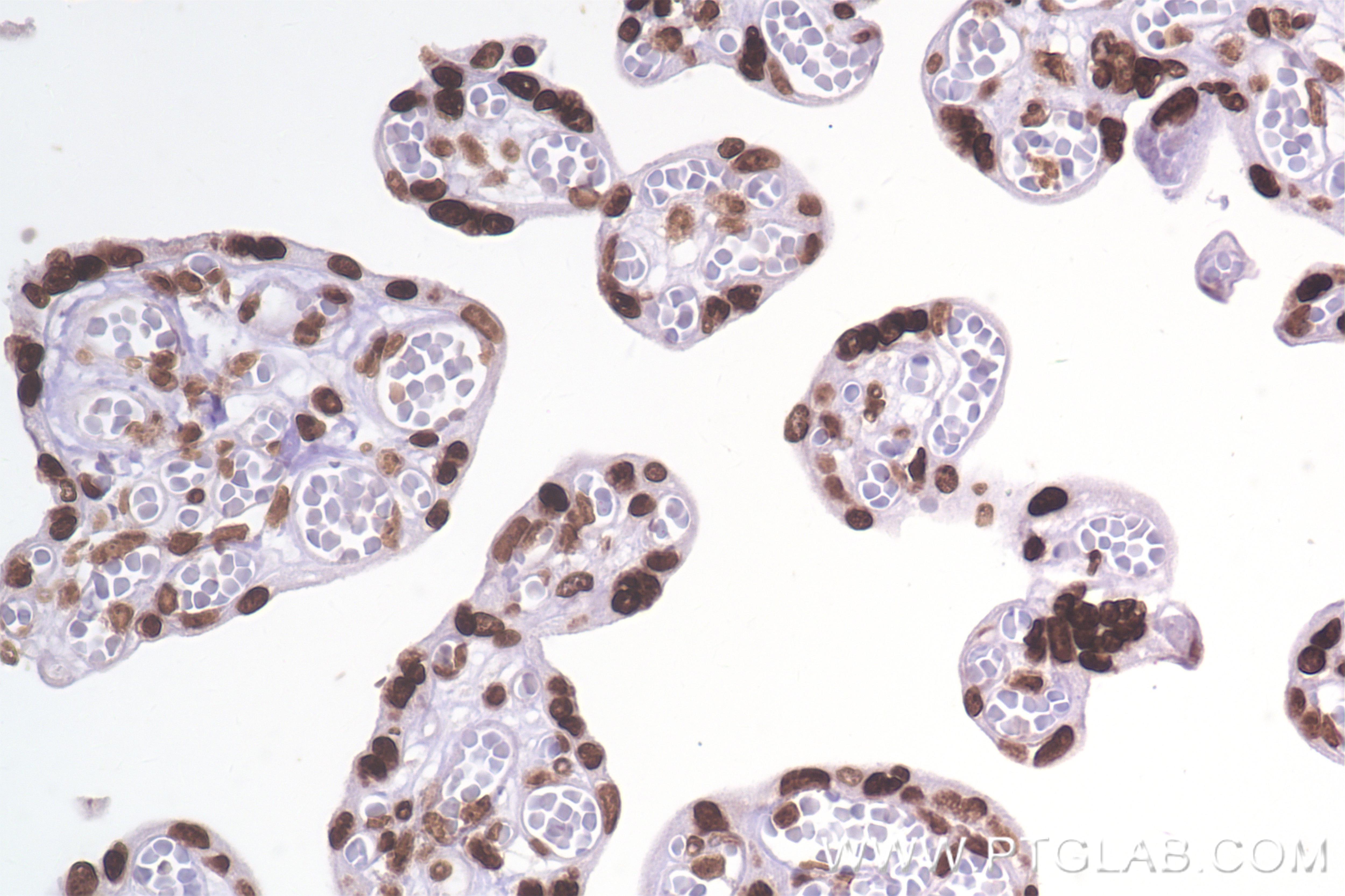 Immunohistochemistry (IHC) staining of human placenta tissue using Di/Tri-Methyl-Histone H3 (Lys36) Recombinant antib (84329-1-RR)