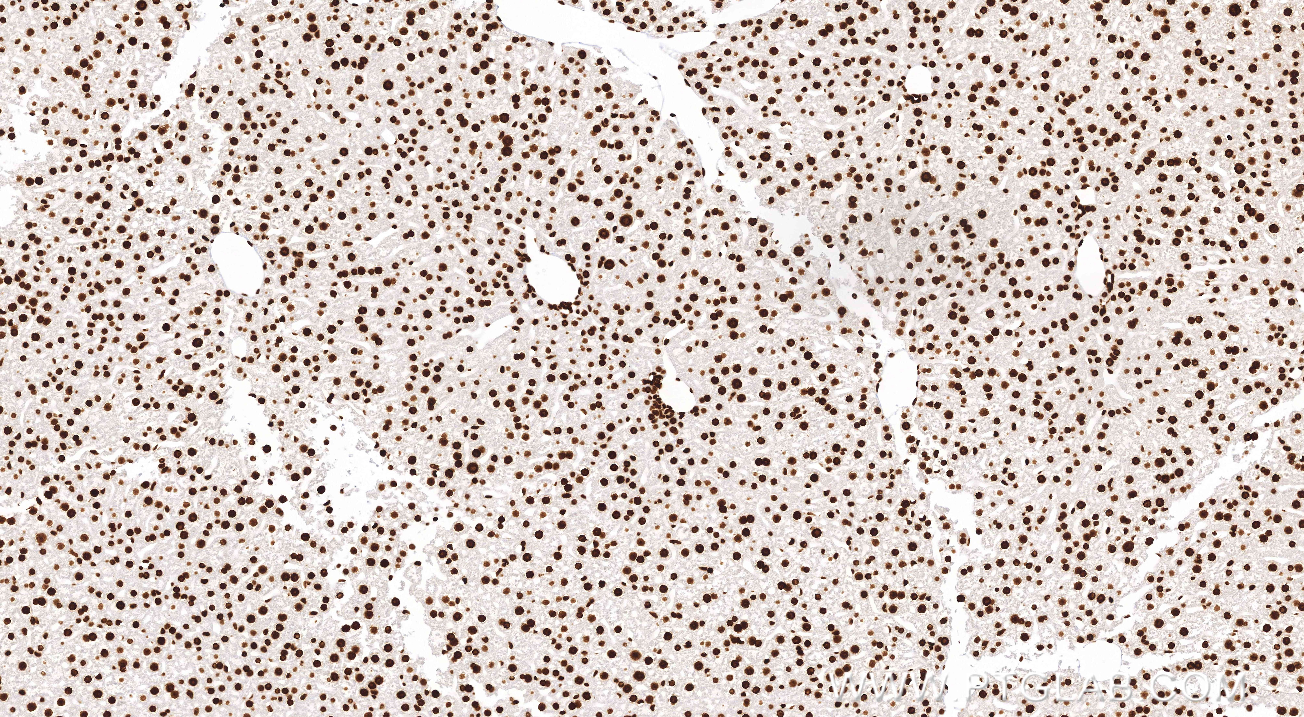 Immunohistochemical analysis of paraffin-embedded mouse liver tissue slide using 84329-1-RR (Di/Tri-Methyl-Histone H3 (Lys36) antibody) at dilution of 1:2000 (under 10x lens). Heat mediated antigen retrieval with Tris-EDTA buffer (pH 9.0). Immunohistochemistry (IHC) staining of mouse liver tissue using Di/Tri-Methyl-Histone H3 (Lys36) Recombinant monoc (84329-1-RR)