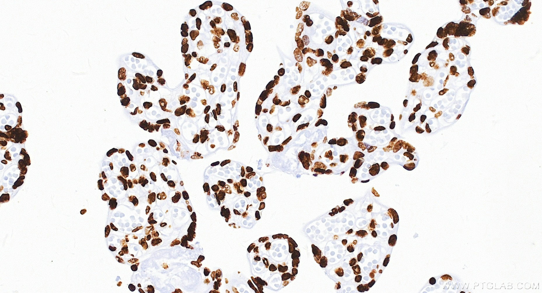 IHC staining of human placenta using 84329-6-RR Immunohistochemistry (IHC) staining of human placenta tissue using Di/Tri-Methyl-Histone H3 (Lys36) Recombinant monoc (84329-6-RR)