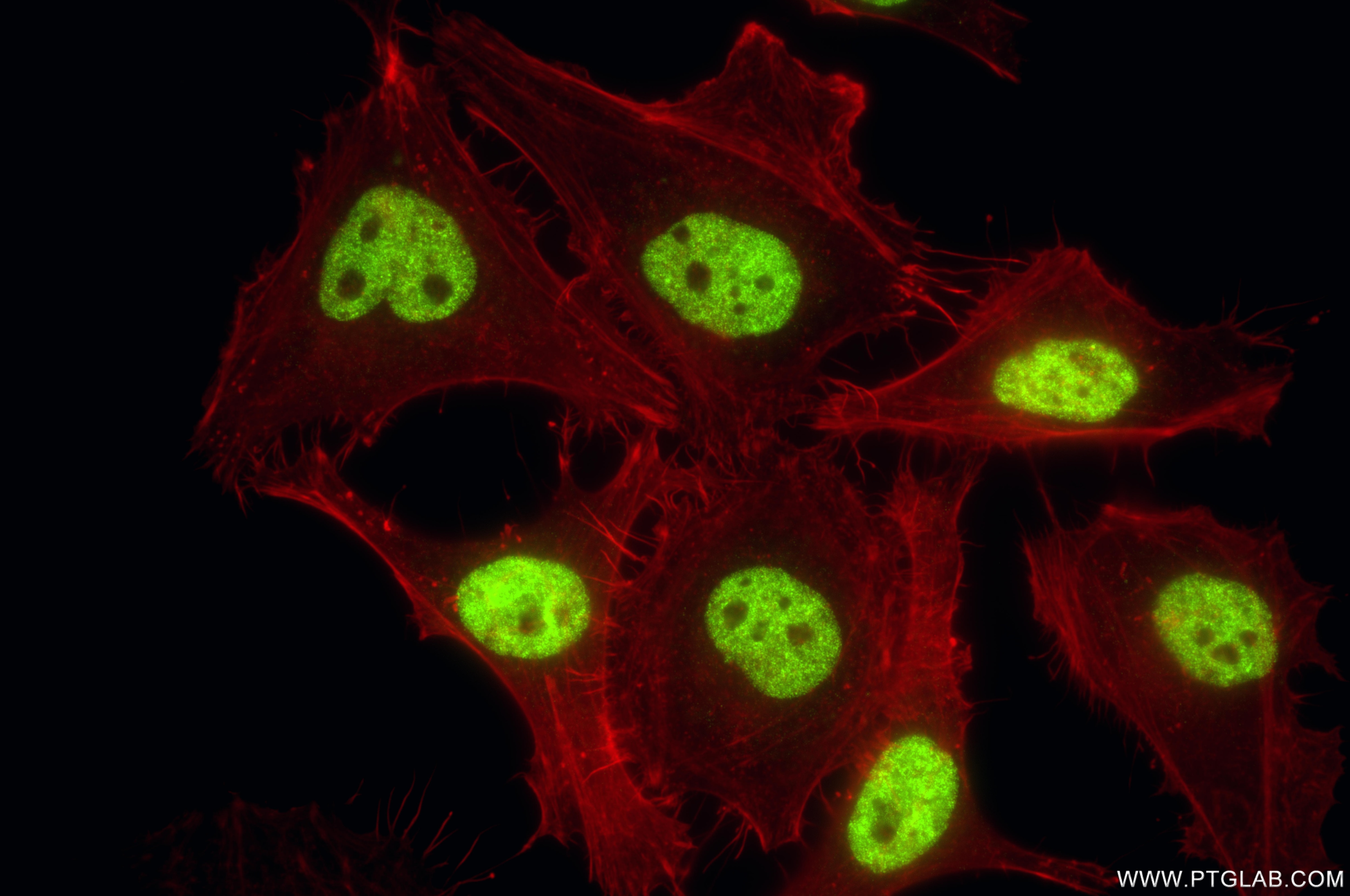 Immunofluorescent analysis of (4% PFA) fixed HeLa cells using Di/Tri-Methyl-Histone H3 (Lys4) antibody (84908-2-RR, Clone: 241942D11 ) at dilution of 1:1000 and CoraLite®488-Conjugated Goat Anti-Rabbit IgG(H+L) (SA00013-2), CL594-Phalloidin (red). This data was developed using the same antibody clone with 84908-2-PBS in a different storage buffer formulation. Immunofluorescence (IF) / fluorescent staining of HeLa cells using Di/Tri-Methyl-Histone H3 (Lys4) Recombinant monocl (84908-2-RR)