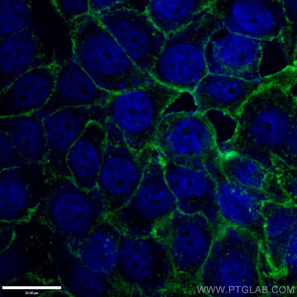 Immunofluorescence (IF) / fluorescent staining of HepG2 cells using Drebrin Polyclonal antibody (25770-1-AP)