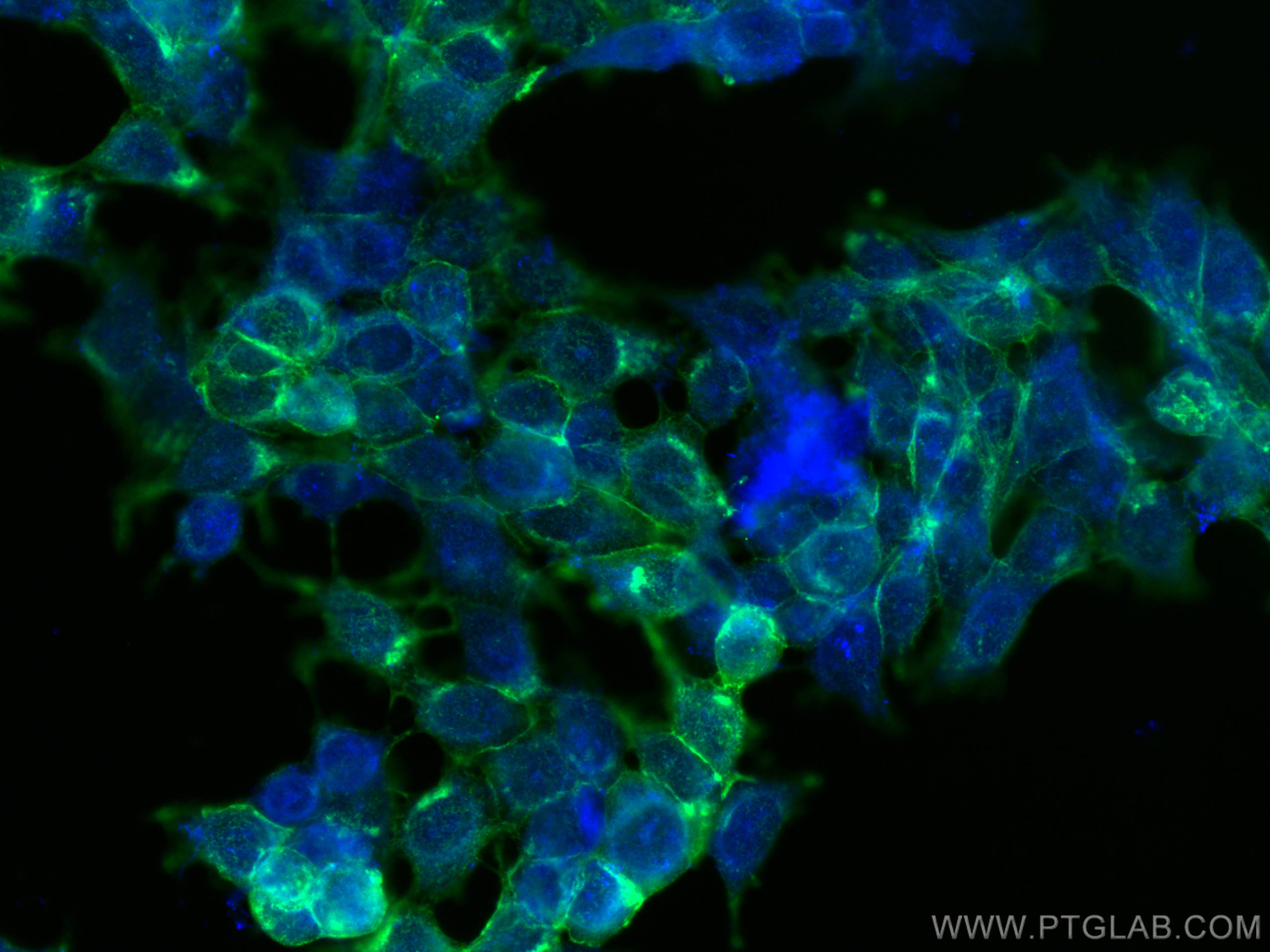 Immunofluorescence (IF) / fluorescent staining of MCF-7 cells using Drebrin Polyclonal antibody (25770-1-AP)