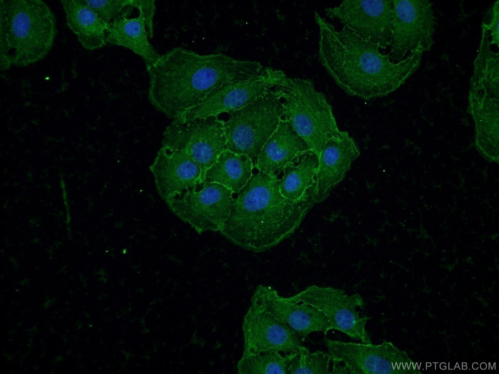 Immunofluorescence (IF) / fluorescent staining of SH-SY5Y cells using Drebrin Polyclonal antibody (25770-1-AP)