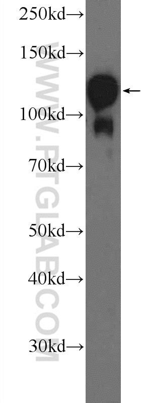 Western Blot (WB) analysis of mouse brain tissue using Drebrin Polyclonal antibody (25770-1-AP)