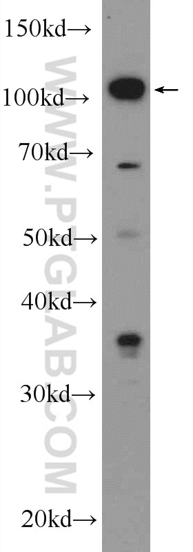 Western Blot (WB) analysis of SH-SY5Y cells using Drebrin Polyclonal antibody (25770-1-AP)