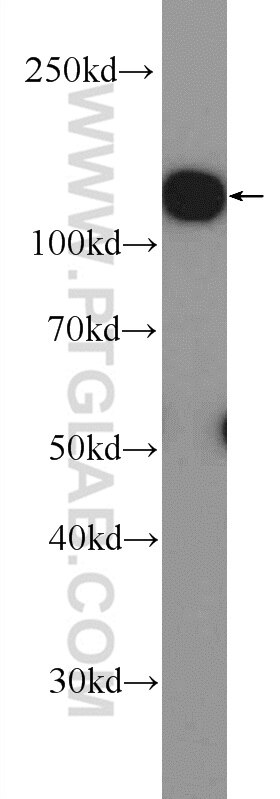 Western Blot (WB) analysis of K-562 cells using Drebrin Polyclonal antibody (25770-1-AP)