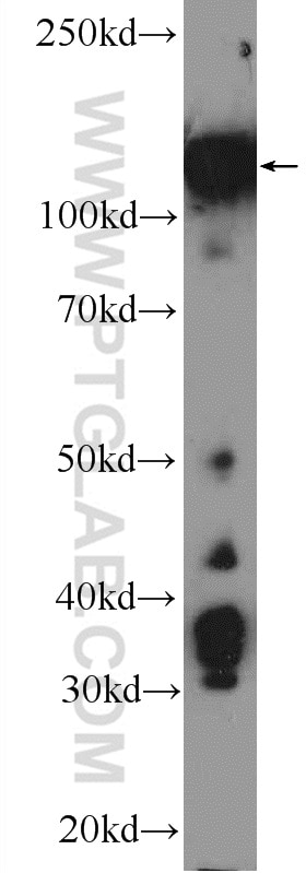 Western Blot (WB) analysis of Neuro-2a cells using Drebrin Polyclonal antibody (25770-1-AP)