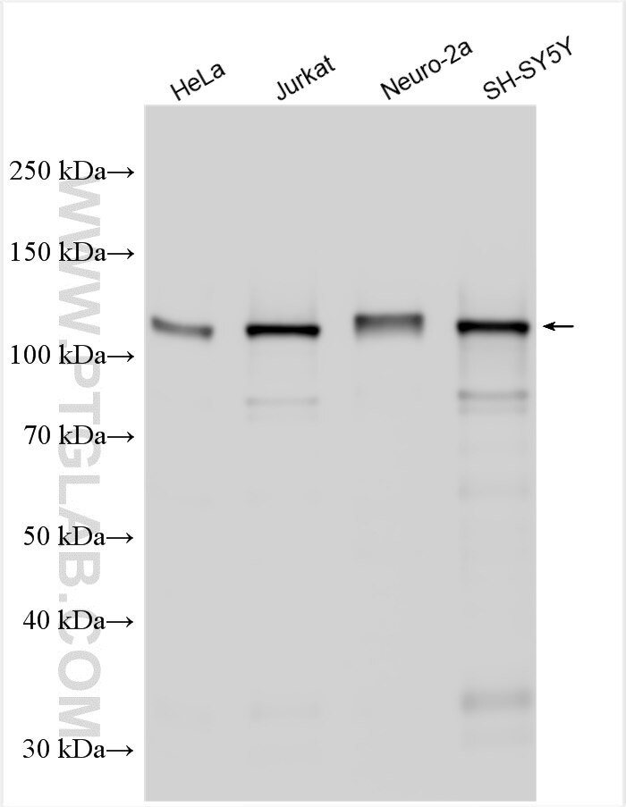 Western Blot (WB) analysis of various lysates using Drebrin Polyclonal antibody (25770-1-AP)