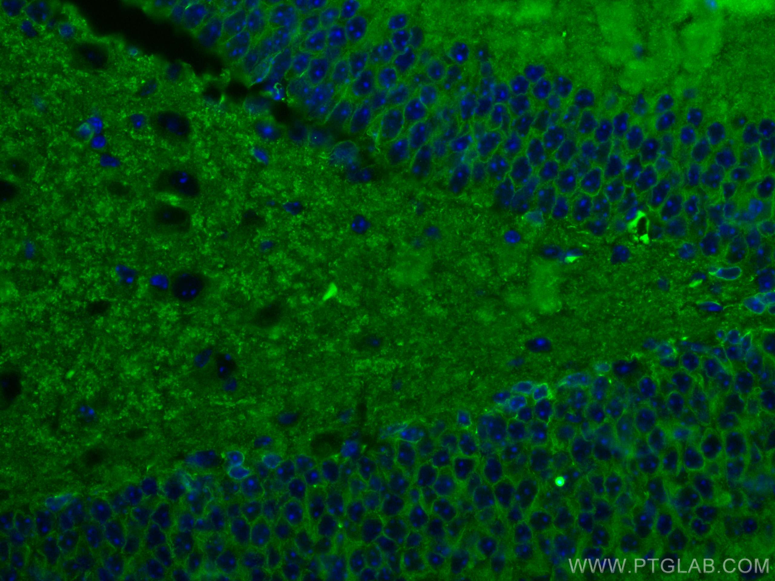 Immunofluorescence (IF) / fluorescent staining of mouse brain tissue using Drebrin Monoclonal antibody (67589-1-Ig)