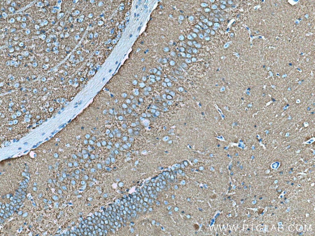 Immunohistochemistry (IHC) staining of mouse brain tissue using Drebrin Monoclonal antibody (67589-1-Ig)