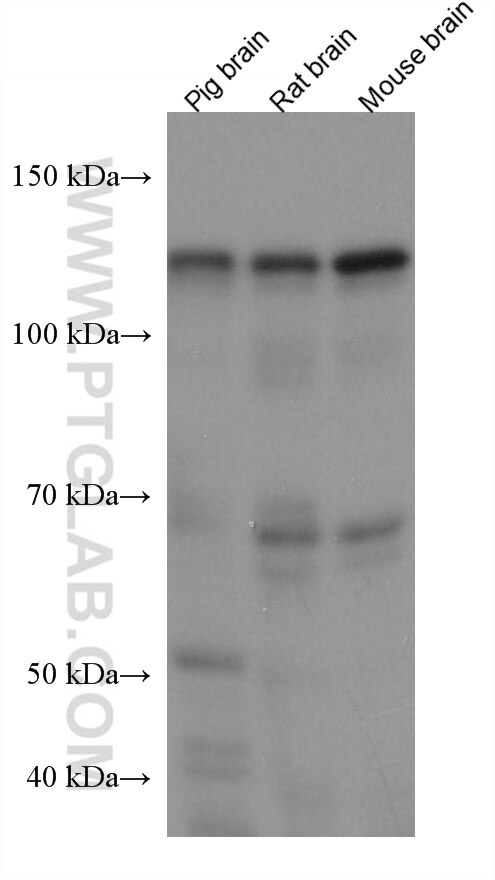 Western Blot (WB) analysis of various lysates using Drebrin Monoclonal antibody (67589-1-Ig)