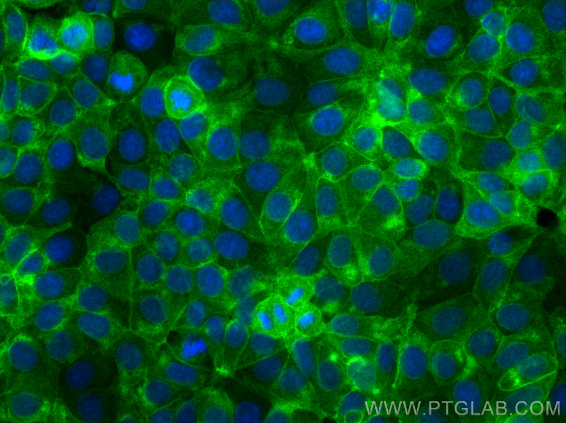 Immunofluorescence (IF) / fluorescent staining of MCF-7 cells using Drebrin Recombinant monoclonal antibody (83591-2-RR)