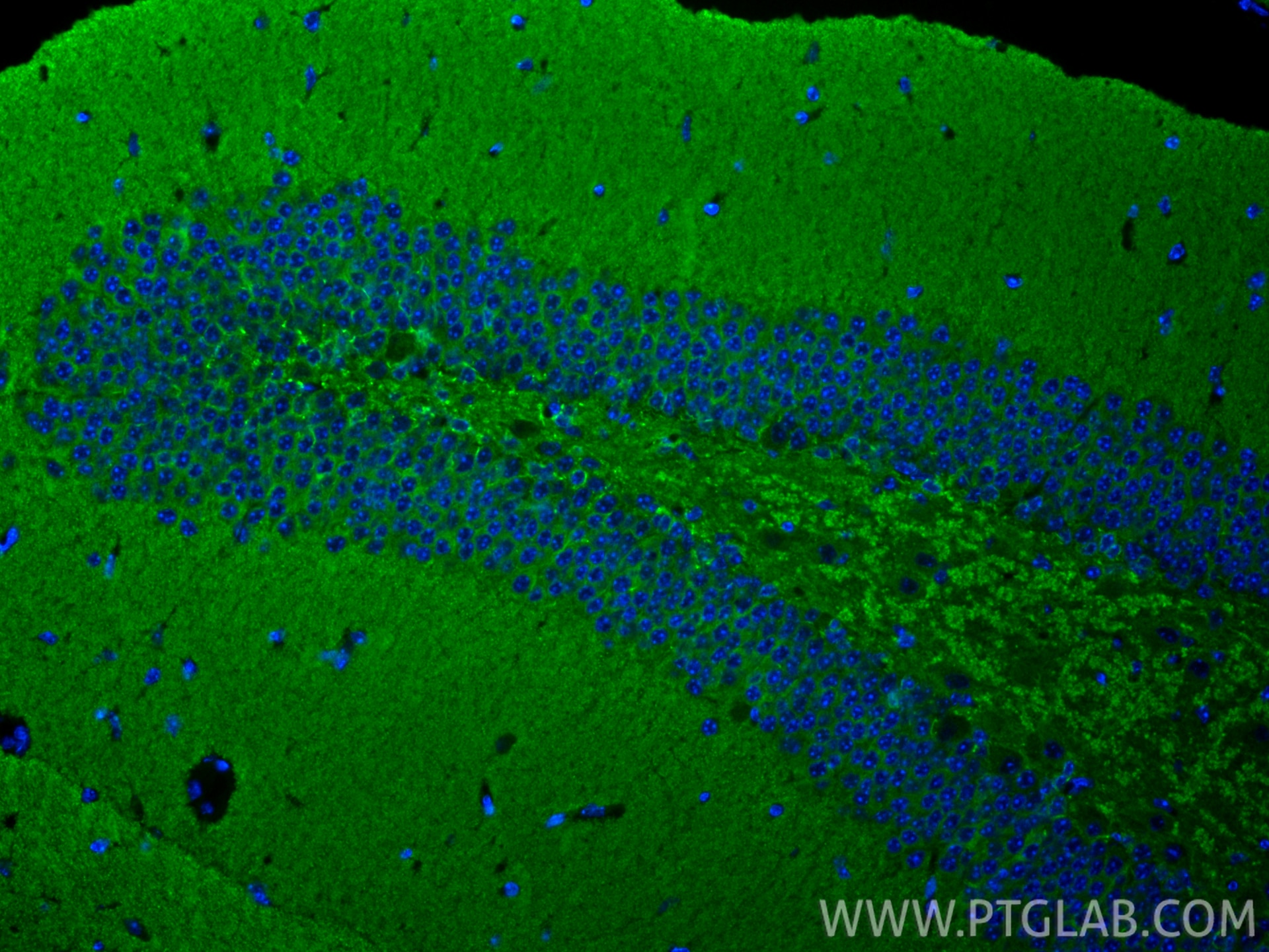 Immunofluorescence (IF) / fluorescent staining of mouse brain tissue using Drebrin Recombinant monoclonal antibody (83591-2-RR)