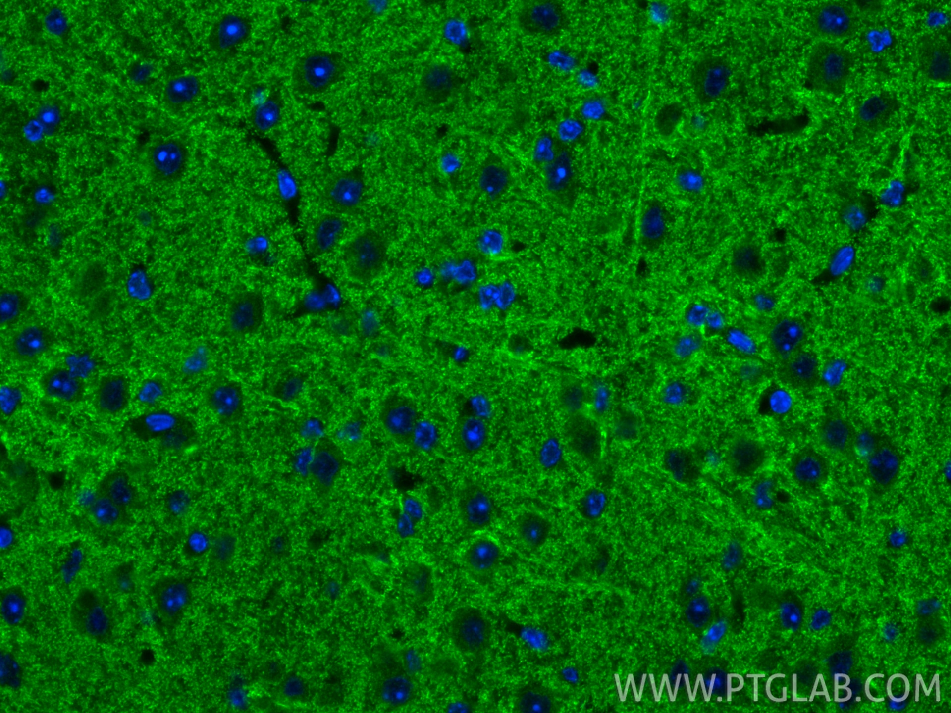 Immunofluorescence (IF) / fluorescent staining of mouse brain tissue using Drebrin Recombinant monoclonal antibody (83591-2-RR)