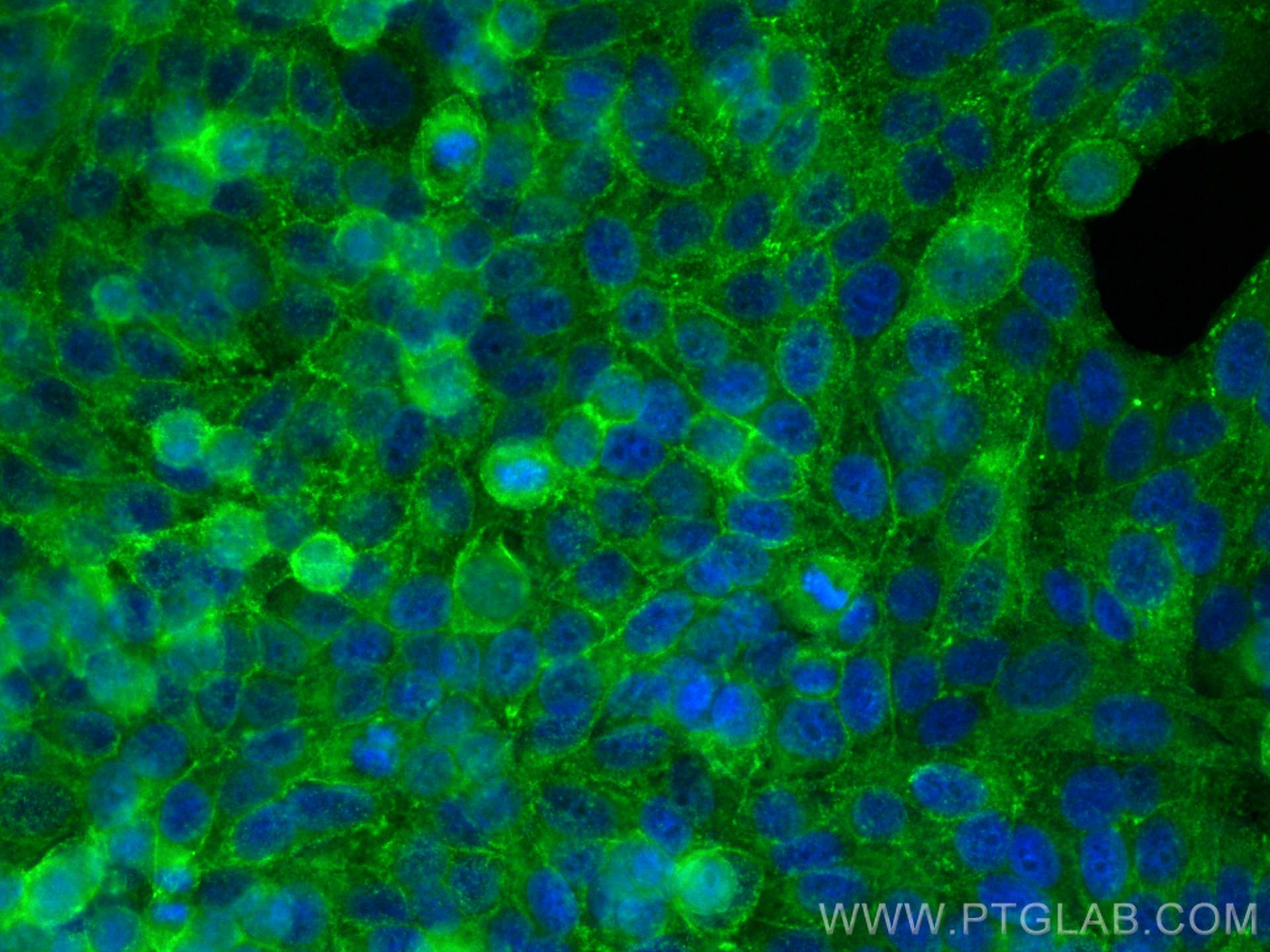 Immunofluorescence (IF) / fluorescent staining of HepG2 cells using CoraLite® Plus 488-conjugated Drebrin Polyclonal a (CL488-10260)