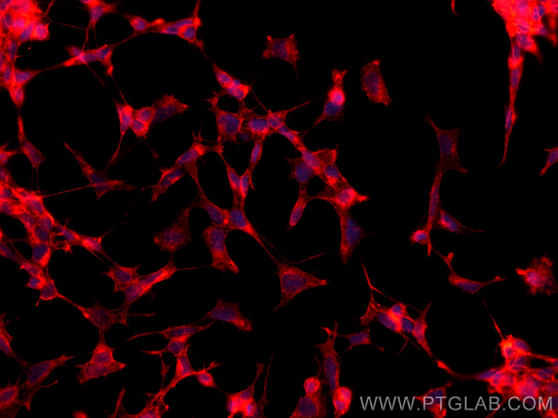 Immunofluorescence (IF) / fluorescent staining of SH-SY5Y cells using CoraLite®594-conjugated Drebrin Monoclonal antibod (CL594-67589)