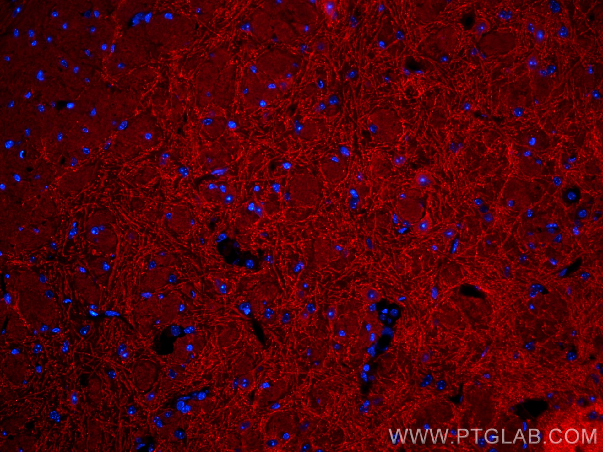 Immunofluorescence (IF) / fluorescent staining of mouse brain tissue using CoraLite®594-conjugated Drebrin Monoclonal antibod (CL594-67589)