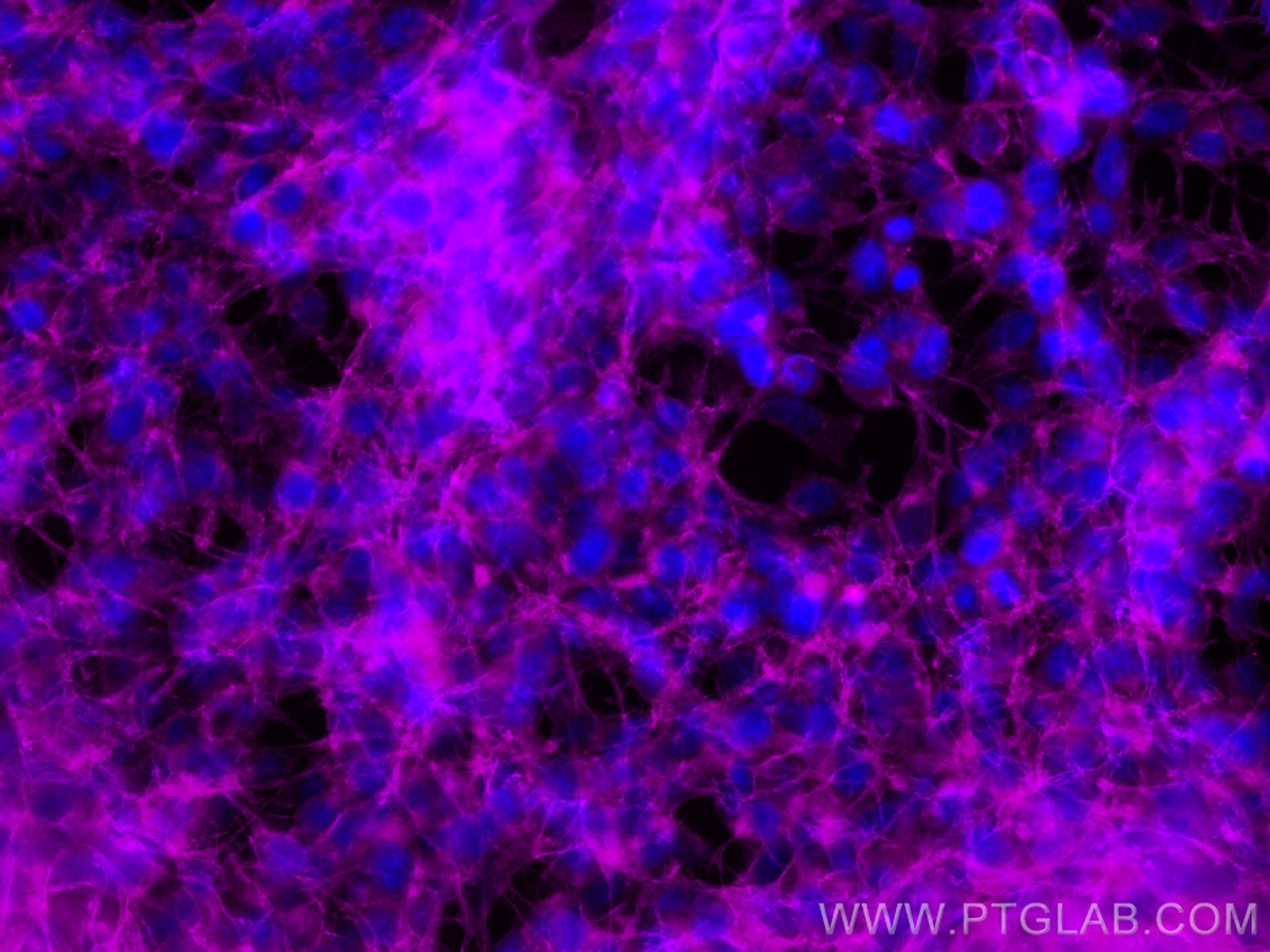 Immunofluorescence (IF) / fluorescent staining of SH-SY5Y cells using CoraLite® Plus 647-conjugated Drebrin Monoclonal a (CL647-67589)