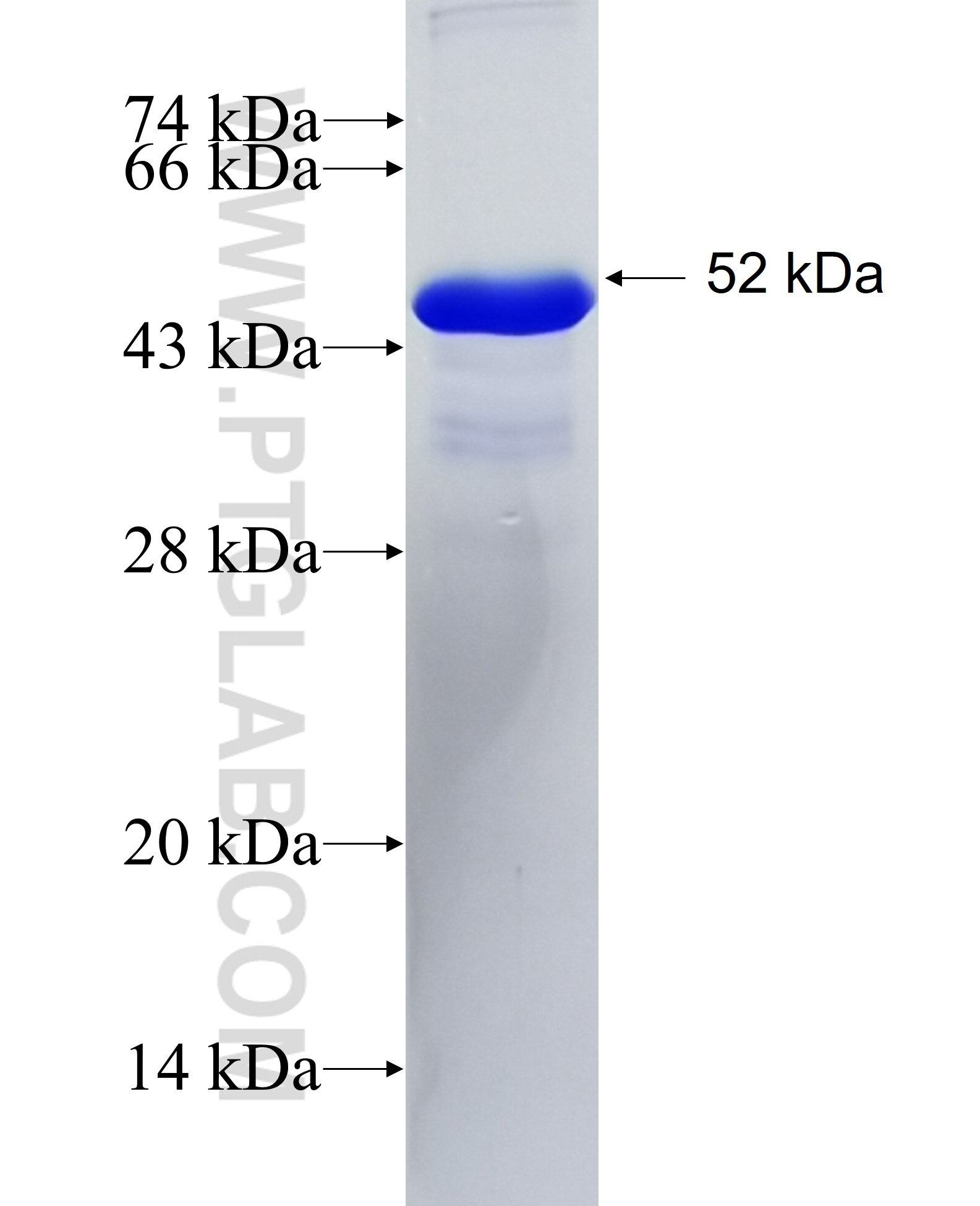 Drebrin fusion protein Ag22635 SDS-PAGE