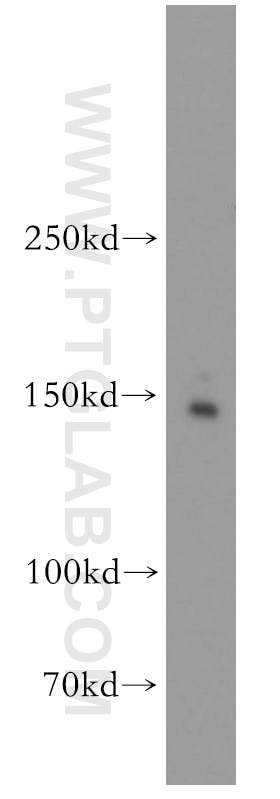 Western Blot (WB) analysis of HEK-293 cells using Drosha Polyclonal antibody (55001-1-AP)