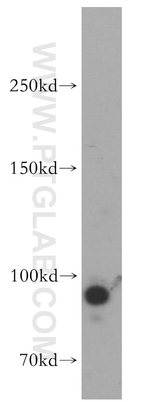 Western Blot (WB) analysis of HepG2 cells using Drosha Polyclonal antibody (55001-1-AP)