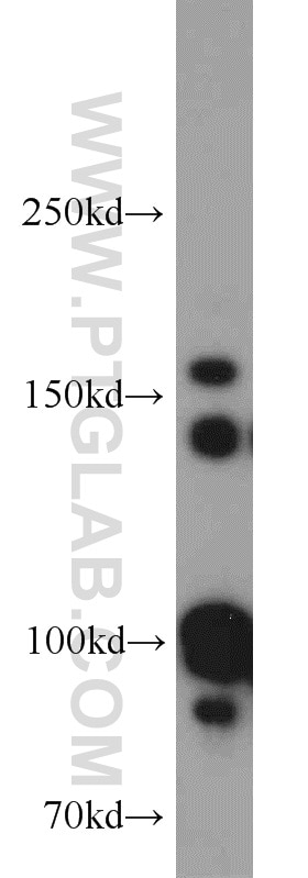 Western Blot (WB) analysis of HepG2 cells using Drosha Polyclonal antibody (55001-1-AP)