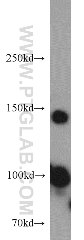 Western Blot (WB) analysis of HepG2 cells using Drosha Polyclonal antibody (55001-1-AP)