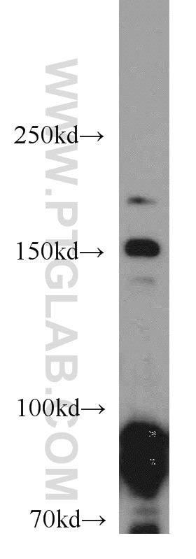 Western Blot (WB) analysis of HEK-293 cells using Drosha Polyclonal antibody (55001-1-AP)