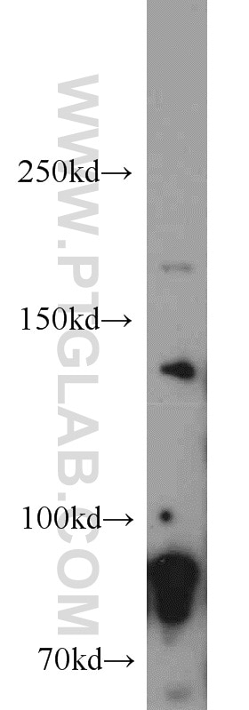 Western Blot (WB) analysis of HEK-293 cells using Drosha Polyclonal antibody (55001-1-AP)